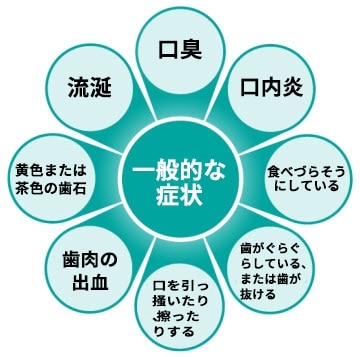 歯周病の一般的な兆候